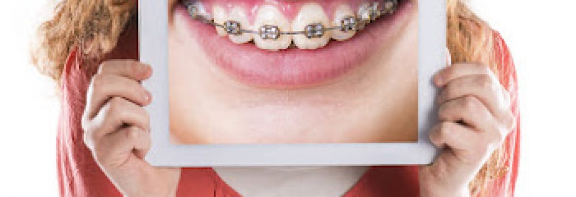 Dent|idea – Kızılay Diş Polikliniği